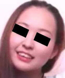 プレミア★ノーズＸＸ　でこちゃんガチ豚鼻