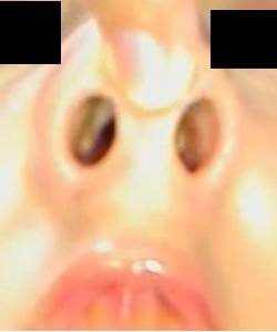 プレミア★ノーズＸＸ　高級美女美鼻限界全開