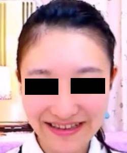 プレミア★ノーズＸＸ　奈落アイドルすっぴん編　