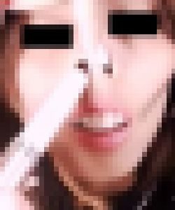 プレミア★ノーズＸＸ　鼻毛ジャングル処理実行