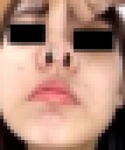 プレミア★ノーズＸＸ　不器用美女のｶﾞﾂ豚