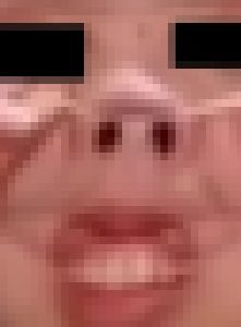 プレミア★ノーズＸＸ　叶う大胆顔壊し美女３作品合体版