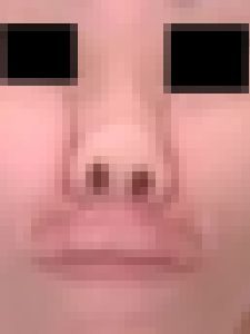 プレミア★ノーズＸＸ　ｱﾌﾞﾉｰﾏﾙＰ顔と鼻毛切り激顔編