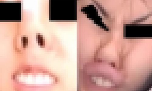 プレミア★ノーズＸＸ　天然美女のﾌﾞﾀﾊﾟﾝﾊﾟﾝﾁ