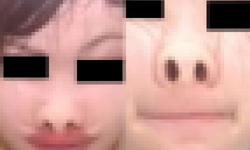 プレミア★ノーズＸＸ　可愛いけど崩しﾀﾞｲｯﾀﾝ