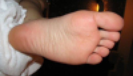 NO.20　足の裏写真集13名分