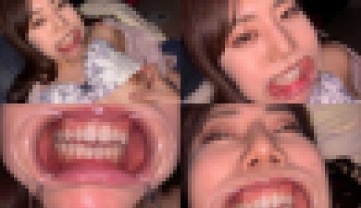 歯姫 30人目 [FBOM-00080]