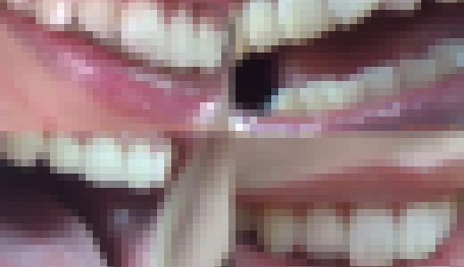【お得なSET販売】綺麗なお姉さまのお口事情[20030100]