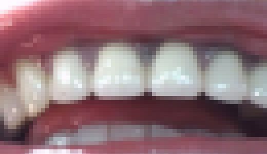 【HD】綺麗なお姉さまのお口事情[20040103]