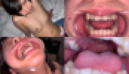 歯姫 34人目 [FBOM-00088]