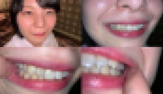 歯姫 37人目 [FBOM-00091]