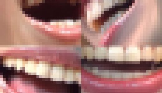 【お得なSET販売】綺麗なお姉さまのお口事情[20030200]