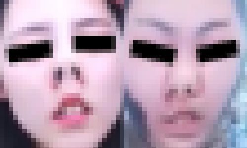 プレミア★ノーズＸＸ　なんでも限界までリクエスト