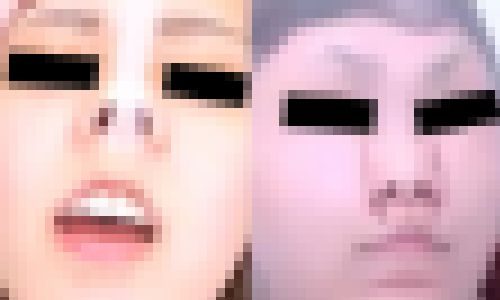 プレミア★ノーズＸＸ　豚鼻を止めるな！