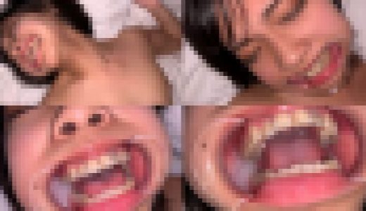 歯姫 40人目 [FBOM-00098]