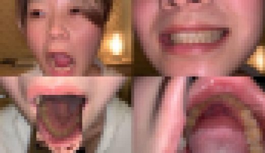 歯姫 43人目 [FBOM-00105]