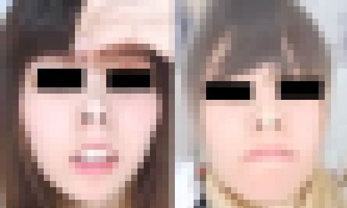 プレミア★ノーズＸＸ　１年ぶりの思入れプレイ