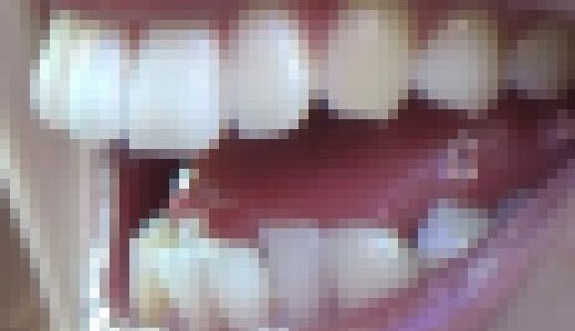 【HD】綺麗なお姉さまのお口事情[20030306]