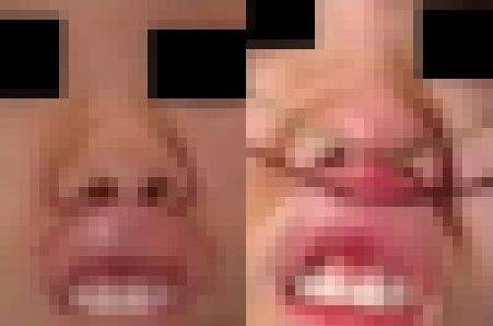 プレミア★ノーズＸＸ　崩しきって私も興奮します激顔編