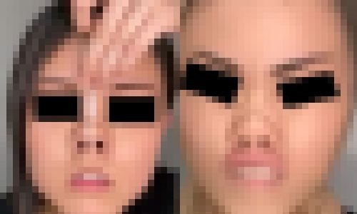 プレミア★ノーズＸＸ　ツンギャル完璧ブタパン