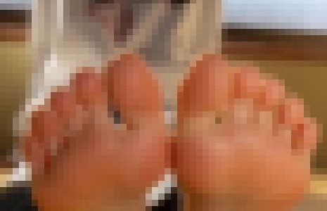19歳学生さんの足の裏