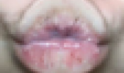 タコチューマニアックNo5～童顔唇ことちゃんPart②～