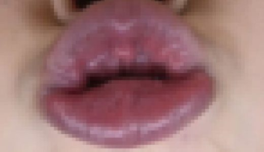 タコチューマニアックNo7～セクシー唇ひなさん～Part①