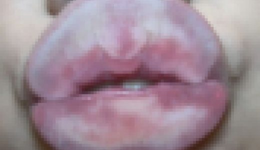 タコチューマニアックNo7～セクシー唇ひなさん～Part②